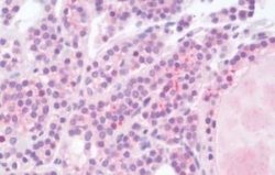 Heparanase/HPSE Antibody, Novus Biologicals 50 &mu;g; Unconjugated:Antibodies,
